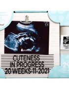 PEARHEAD Rama foto ecografie cu litere pentru personalizare