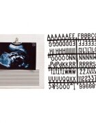 PEARHEAD Rama foto ecografie cu litere pentru personalizare
