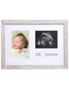 PEARHEAD Rama foto pentru ecografie si bratara din maternitate