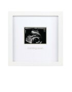 PEARHEAD Rama foto pentru pastrarea ecografiei