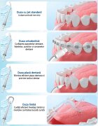 PERFECT MEDICAL Set 4 duze interschimbabile pentru irigator bucal