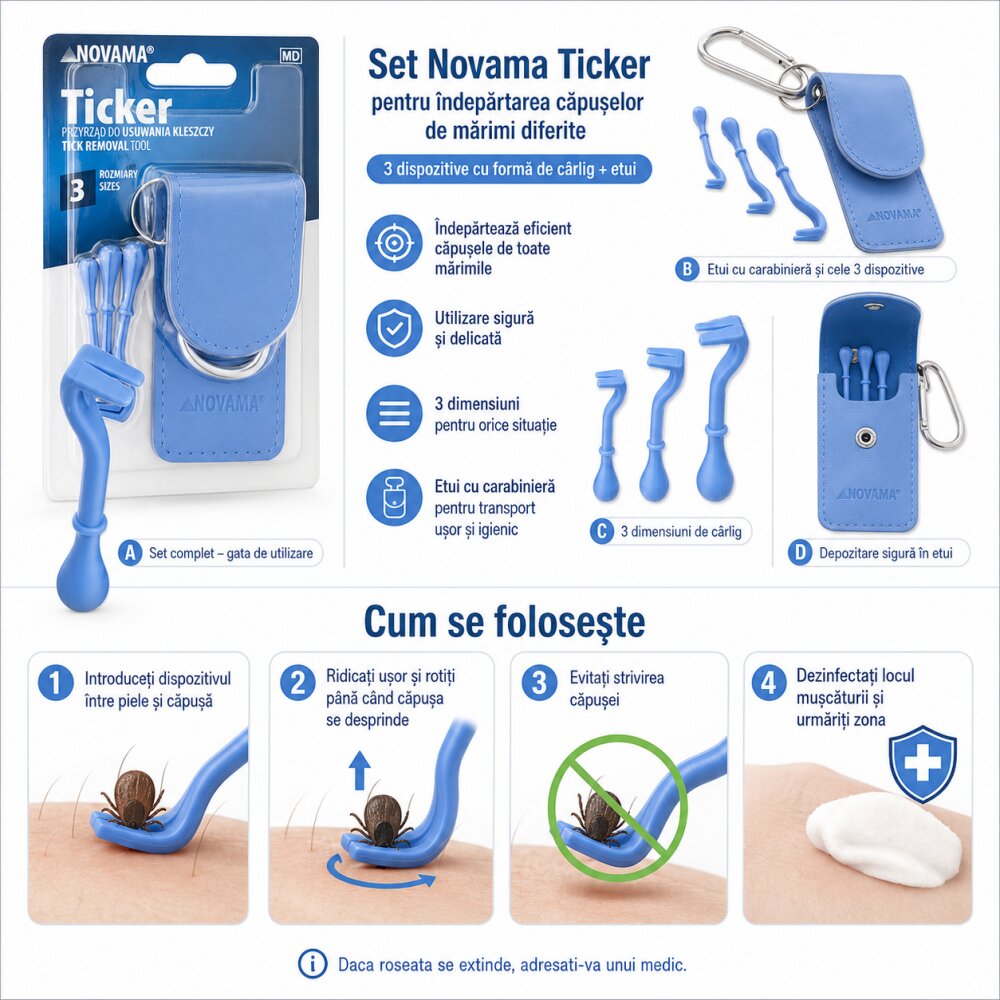 NOVAMA Set Ticker pentru indepartarea capuselor de marimi diferite 3 dispozitive cu forma de carlig etui