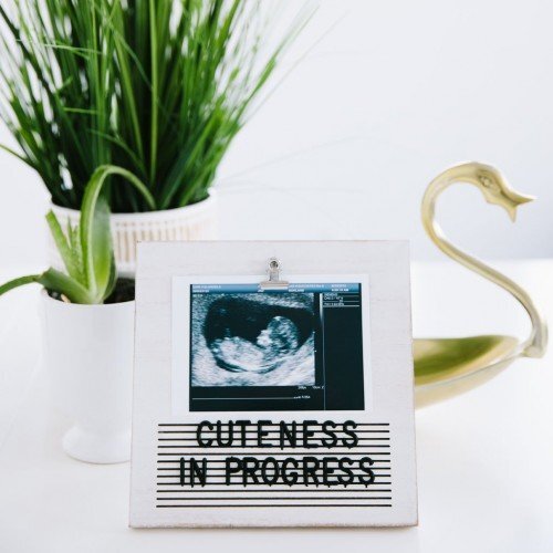 PEARHEAD Rama foto ecografie cu litere pentru personalizare