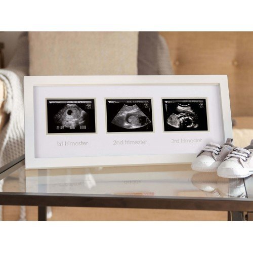 PEARHEAD Rama foto pentru ecografii