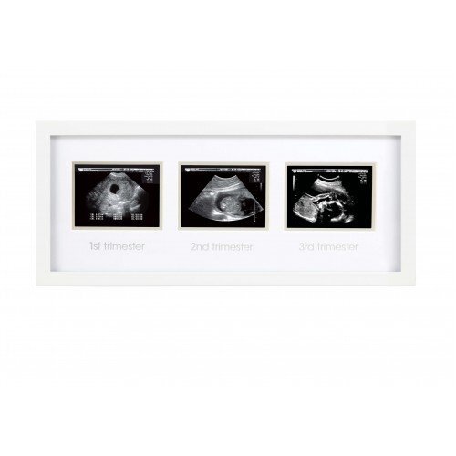 PEARHEAD Rama foto pentru ecografii
